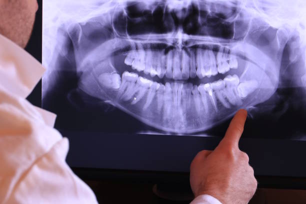 Best Emergency Dentist for Knocked-Out Tooth in Eutaw, AL
