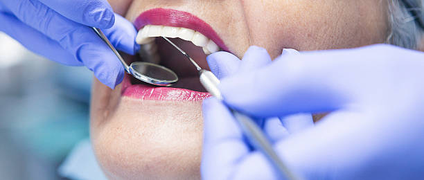 Best Emergency Dentist for Lost Fillings or Crowns in Eutaw, AL